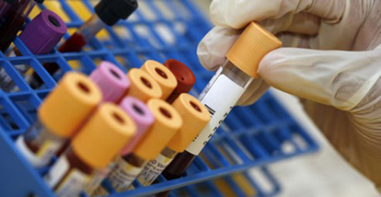 Progesteron Testi Nasıl Yapılır?